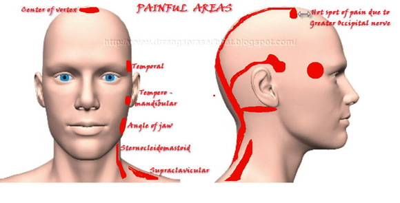 painful-areas-in-occipital-neuralgia-labelled1
