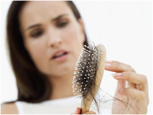 hair-loss-after-pregnancy